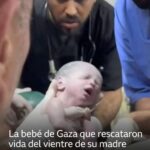 La bebé de Gaza que rescataron con vida del vientre de su madre muerta en un ataque de Israel