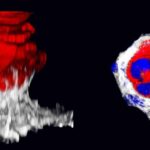 El descubrimiento de por qué solo sobreviven algunos tumores tempranos podría ayudar a detectar y tratar el cáncer en etapas muy tempranas.