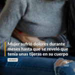 Mujer sufrió dolores durante meses hasta que un examen reveló que tenía unas tijeras en su cuerpo