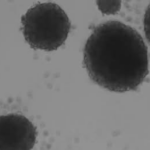 Un equipo catalán diseña un método con luz capaz de activar una molécula y eliminar las células madre del cáncer, que causan las recaídas