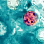 La ‘cyclospora’ se dispara en Estados Unidos: qué es esta enfermedad parasitaria que provoca diarrea ‘explosiva’ 