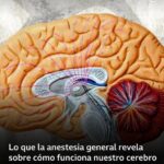 “Uno de los grandes misterios de la ciencia”: lo que la anestesia general revela sobre cómo funciona nuestro cerebro