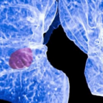 La IA encuentra pistas del riesgo de cáncer en los análisis de sangre que ya nos hacemos